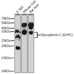 Glycophorin C Rabbit anti-Human, Mouse, Rat, Clone: 9K8U2, Novus Biologicals 20 &mu;g | Buy Online | Novus Biologicals | Fisher Scientific