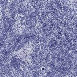 Glypican 1 Rabbit anti-Human, Polyclonal, Novus Biologicals:Antibodies:Primary