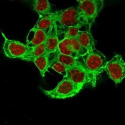 Glypican 3 Antibody (1G12 + GPC3/863), Novus Biologicals:Antibodies:Primary