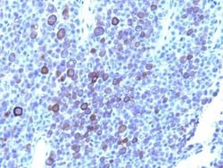 Glypican 3 Antibody (1G12 + GPC3/863), Novus Biologicals:Antibodies:Primary