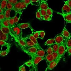Glypican 3 Antibody (1G12), Novus Biologicals 0.1mg; Unlabeled:Antibodies,