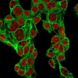 Glypican 3 Antibody (GPC3/1534R), Novus Biologicals 20&mu;g; Unlabeled:Antibodies,