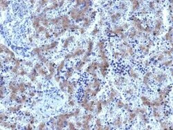 Glypican 3 Antibody (GPC3/1534R), Novus Biologicals 20&mu;g; Unlabeled:Antibodies,