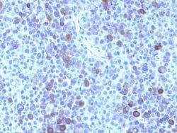 Glypican 3 Antibody (GPC3/863), Novus Biologicals 0.02mg; Unlabeled:Antibodies,