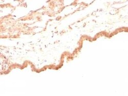 Glypican 3 Antibody (GPC3/863), Novus Biologicals 0.02mg; Unlabeled:Antibodies,