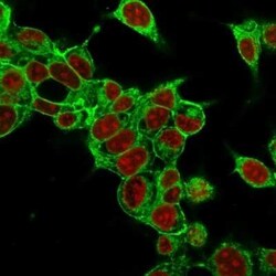 Glypican 3 Antibody (SPM595), Novus Biologicals:Antibodies:Primary Antibodies