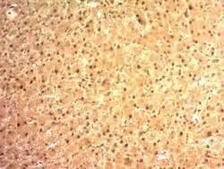 Glypican 3 Antibody (SPM595), Novus Biologicals:Antibodies:Primary Antibodies