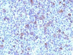 Glypican 3 Antibody (SPM595), Novus Biologicals:Antibodies:Primary Antibodies