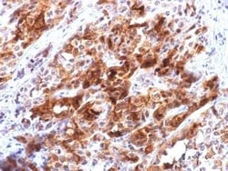 Glypican 3 Antibody (rGPC3/863), Novus Biologicals 20&mu;g; Unlabeled:Antibodies,