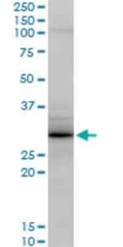 Grancalcin Antibody (2F11), Novus Biologicals 0.1 mg | Buy Online | Novus Biologicals | Fisher Scientific