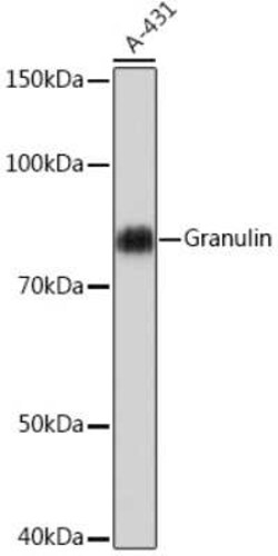 Granulin Rabbit anti-Human, Clone: 4X3I7, Novus Biologicals 20 &mu;g; Unconjugated:Antibodies,