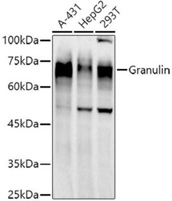 Granulin Rabbit anti-Human, Clone: 8O5Q5, Novus Biologicals:Antibodies:Primary