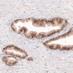 Granulin Antibody (CL5692), Novus Biologicals 25 &mu;L:Antibodies, Monoclonal
