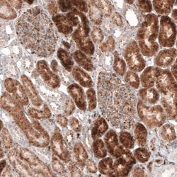 Granulin Antibody (CL5692), Novus Biologicals 25 &mu;L:Antibodies, Monoclonal