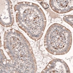 Granulin Antibody (CL5692), Novus Biologicals 25 &mu;L:Antibodies, Monoclonal
