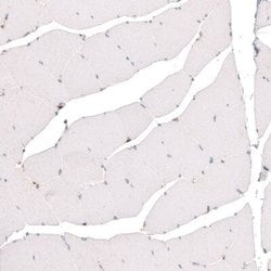 Granulin Antibody (CL5692), Novus Biologicals 25 &mu;L:Antibodies, Monoclonal