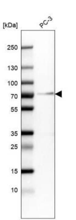 Granulin Antibody (CL5695), Novus Biologicals:Antibodies:Primary Antibodies