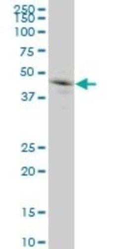 Granulin Antibody (1F5), Novus Biologicals 0.1 mg | Buy Online | Novus Biologicals | Fisher Scientific