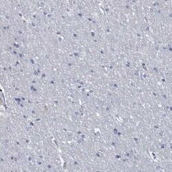 Granzyme A Rabbit anti-Human, Polyclonal, Novus Biologicals 25 &mu;g | Buy Online | Novus Biologicals | Fisher Scientific