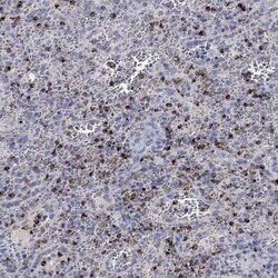 Granzyme A Rabbit anti-Human, Polyclonal, Novus Biologicals 25 &mu;g | Buy Online | Novus Biologicals | Fisher Scientific