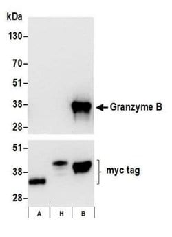 Granzyme B Antibody (BLR022E), Novus Biologicals 100 &mu;L; Unconjugated:Antibodies,
