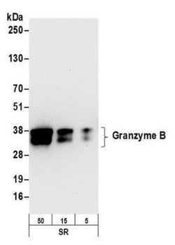 Granzyme B Antibody (BLR022E), Novus Biologicals 100 &mu;L; Unconjugated:Antibodies,