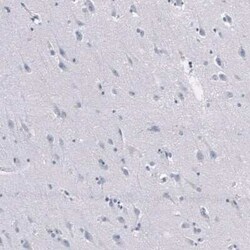 Granzyme B Antibody (CL10662), Novus Biologicals 25 &mu;g; Unconjugated:Antibodies,