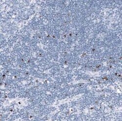 Granzyme B Antibody (CL10662), Novus Biologicals 25 &mu;g; Unconjugated:Antibodies,