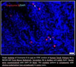 Granzyme B Antibody, Novus Biologicals 0.1mL; Unlabeled:Antibodies, Polyclonal