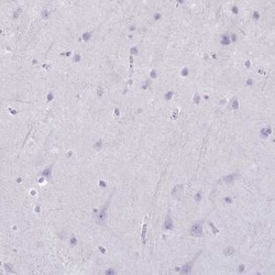 Granzyme K Antibody, Novus Biologicals 25 &mu;L, Unconjugated:Antibodies,