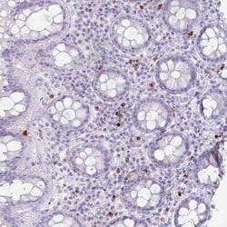 Granzyme K Antibody, Novus Biologicals 25 &mu;L, Unconjugated:Antibodies,