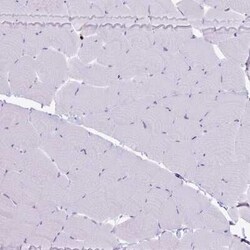 Granzyme K Antibody, Novus Biologicals 25 &mu;L, Unconjugated:Antibodies,