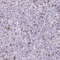 Granzyme K Antibody, Novus Biologicals 25 &mu;L, Unconjugated:Antibodies,