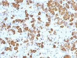 Growth Hormone Antibody (GH/1371), Novus Biologicals:Antibodies:Primary