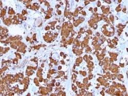 Growth Hormone Antibody (GH/1371), Novus Biologicals:Antibodies:Primary