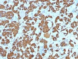 Growth Hormone Antibody (SPM106), Novus Biologicals 100&mu;g; Unlabeled:Antibodies,