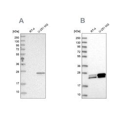 Guanylate kinase Antibody, Novus Biologicals Guanylate kinase Antibody;