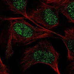 Guanylyl Cyclase alpha 1 Antibody, Novus Biologicals:Antibodies:Primary