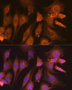 Guanylyl Cyclase beta 1 Rabbit anti-Human, Mouse, Rat, Clone: 5O8D9, Novus