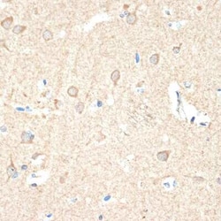 Guanylyl Cyclase beta 1 Rabbit anti-Human, Mouse, Rat, Clone: 5O8D9, Novus