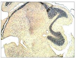 Guanylyl Cyclase beta 1 Antibody, Novus Biologicals 100 &mu;g; Unconjugated:Antibodies,