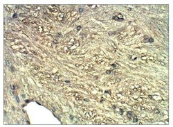 Guanylyl Cyclase beta 1 Antibody, Novus Biologicals 100 &mu;g; Unconjugated:Antibodies,