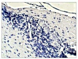 Guanylyl Cyclase beta 1 Antibody, Novus Biologicals 100 &mu;g; Unconjugated:Antibodies,