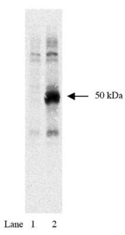 HA-1 Mouse anti-Nonspecies specific, Clone: 12CA5, Novus Biologicals 100