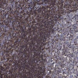 HA-1 Rabbit anti-Human, Polyclonal, Novus Biologicals 100 &mu;g | Buy Online | Novus Biologicals | Fisher Scientific