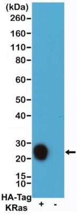HA Tag Antibody (RM305), Novus Biologicals 100 &mu;g | Buy Online | Novus Biologicals | Fisher Scientific