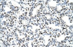 HA95/AKAP8L Antibody, Novus Biologicals 100 &mu;L; Unconjugated:Antibodies,