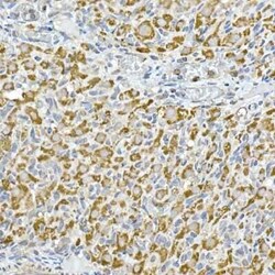 HABP1/C1QBP/GC1q R Rabbit anti-Human, Mouse, Rat, Clone: 4T1W10, Novus