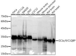 HABP1/C1QBP/GC1q R Rabbit anti-Human, Mouse, Rat, Clone: 4T1W10, Novus