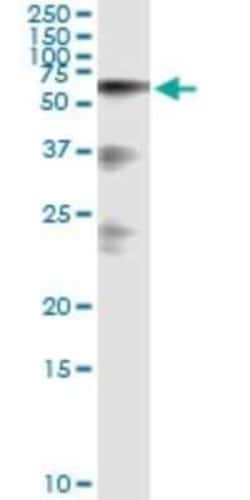 HABP2 Antibody (1H4), Novus Biologicals 0.1 mg | Buy Online | Novus Biologicals | Fisher Scientific